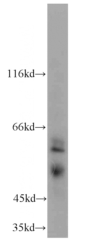 human testis tissue were subjected to SDS PAGE followed by western blot with Catalog No:114292(PSAPL1 antibody) at dilution of 1:200