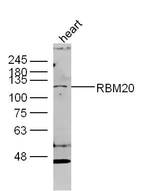 Fig1: Sample: heart (mouse) Lysate at 40 ug; Primary: Anti- RBM20 at 1/300 dilution; Secondary: IRDye800CW Goat Anti-Rabbit IgG at 1/20000 dilution; Predicted band size: 75kD; Observed band size: 75 kD