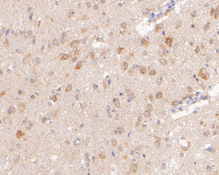 Fig4:; Immunohistochemical analysis of paraffin-embedded rat brain tissue using anti-SYNDIG1 antibody. The section was pre-treated using heat mediated antigen retrieval with Tris-EDTA buffer (pH 8.0-8.4) for 20 minutes.The tissues were blocked in 5% BSA for 30 minutes at room temperature, washed with ddH; 2; O and PBS, and then probed with the primary antibody ( 1/400) for 30 minutes at room temperature. The detection was performed using an HRP conjugated compact polymer system. DAB was used as the chromogen. Tissues were counterstained with hematoxylin and mounted with DPX.