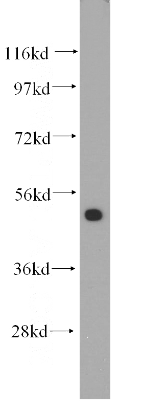 Jurkat cells were subjected to SDS PAGE followed by western blot with Catalog No:109926(DHRS9 antibody) at dilution of 1:200