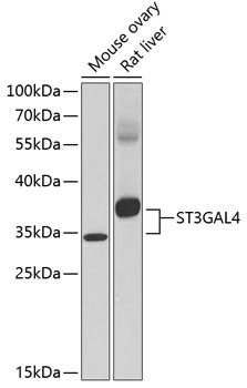 Western blot - ST3GAL4 Polyclonal Antibody 