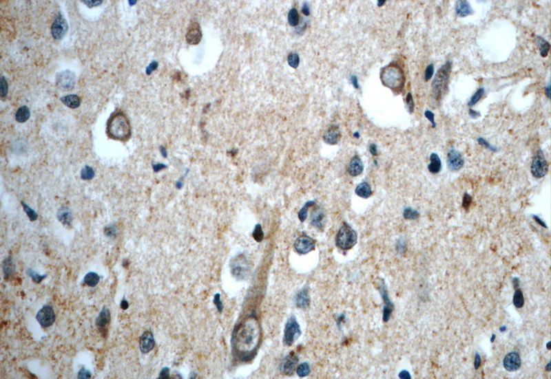 Immunohistochemistry of paraffin-embedded human brain slide using Catalog No:113961(PLEKHF1 Antibody) at dilution of 1:50
