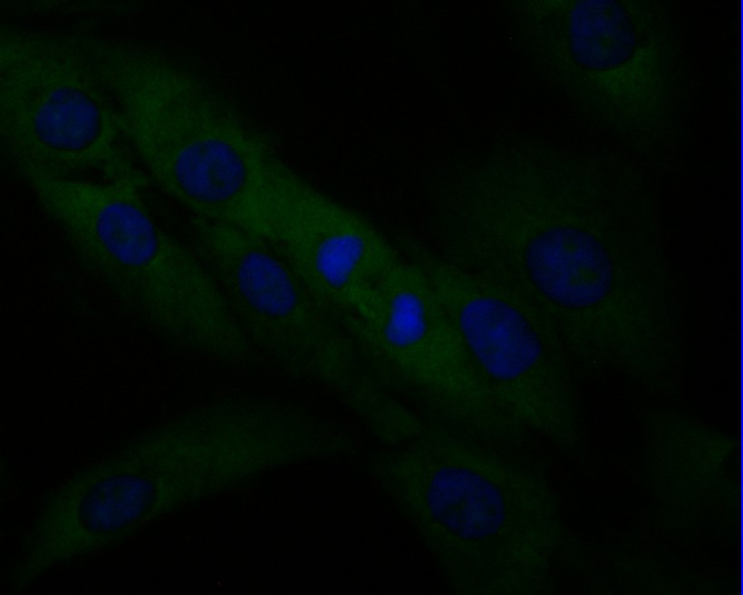 Fig4: ICC staining of SPATA5L1 in MG-63 cells (green). Formalin fixed cells were permeabilized with 0.1% Triton X-100 in TBS for 10 minutes at room temperature and blocked with 1% Blocker BSA for 15 minutes at room temperature. Cells were probed with the primary antibody ( 1/50) for 1 hour at room temperature, washed with PBS. Alexa Fluor®488 Goat anti-Mouse IgG was used as the secondary antibody at 1/1,000 dilution. The nuclear counter stain is DAPI (blue).