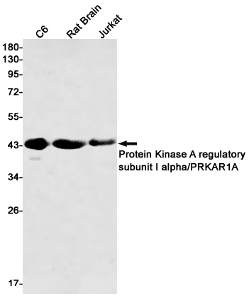 Western blot detection of Protein Kinase A regulatory subunit I alpha/PRKAR1A in C6,Rat Brain,Jurkat cell lysates using Protein Kinase A regulatory subunit I alpha/PRKAR1A Rabbit mAb(1:500 diluted).Predicted band size:43kDa.Observed band size:43kDa.
