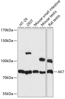 Western blot - AK7 Polyclonal Antibody 