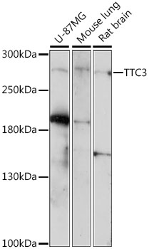 Western blot - TTC3 Polyclonal Antibody 