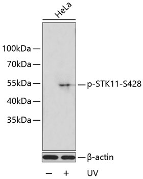 Western blot - Phospho-STK11-S428 pAb 