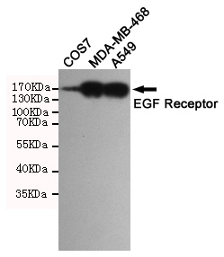 Western blot detection of EGFR in A549,MDA-MB-468 and COS7 cell lysates using EGFR mouse mAb(dilution 1:1000).Predicted band size:134 Kda.Observed band size:175KDa.