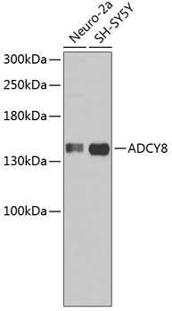 Western blot - ADCY8 Polyclonal Antibody 