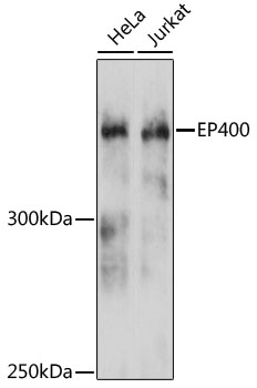 Western blot - EP400 Polyclonal Antibody 