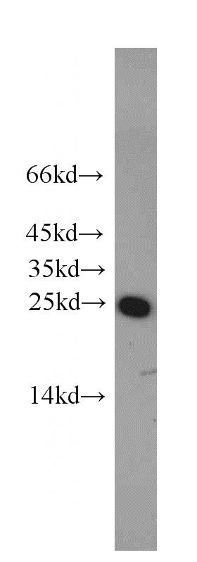 mouse brain tissue were subjected to SDS PAGE followed by western blot with Catalog No:114453(RAB5A antibody) at dilution of 1:500