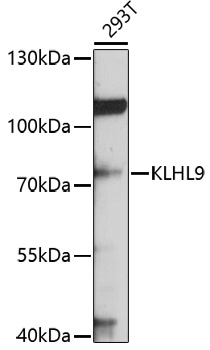 Western blot - KLHL9 Polyclonal Antibody 