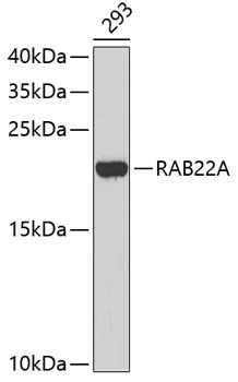Western blot - RAB22A Polyclonal Antibody 
