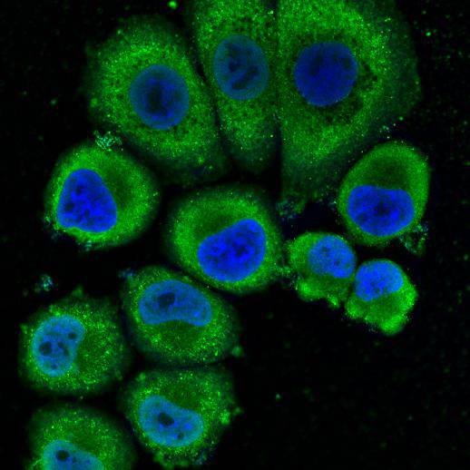 Fig2: ICC staining CD332 in SK-BR-3 cells (green). Cells were fixed in paraformaldehyde, permeabilised with 0.25% Triton X100/PBS and counterstained with DAPI in order to highlight the nucleus (blue).