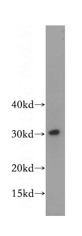 human liver tissue were subjected to SDS PAGE followed by western blot with Catalog No:115598(SRPRB antibody) at dilution of 1:400