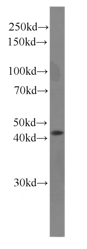 HEK-293 cells were subjected to SDS PAGE followed by western blot with Catalog No:107445(p504S,AMACR antibody) at dilution of 1:1000