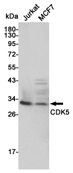 Western blot detection of CDK5 in Jurkat and MCF7 lysates using CDK5 mouse mAb (1:1000 diluted).Predicted band size: 36KDa.Observed band size: 30KDa.