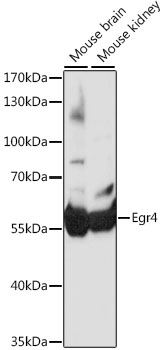 Western blot - Egr4 Polyclonal Antibody 