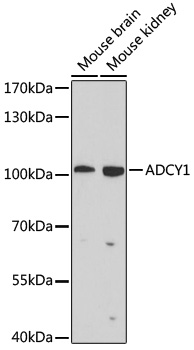 Western blot - ADCY1 Polyclonal Antibody 