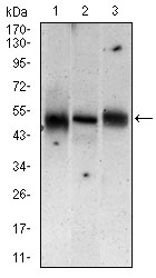 Western blot analysis using MAP2K5 mouse mAb against Jurkat (1), A431 (2), A549 (3) cell lysate.
