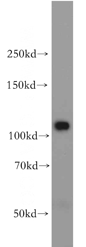 HepG2 cells were subjected to SDS PAGE followed by western blot with Catalog No:113873(PIK3CB antibody) at dilution of 1:500
