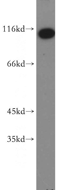 HeLa cells were subjected to SDS PAGE followed by western blot with Catalog No:114751(RNF20 antibody) at dilution of 1:500