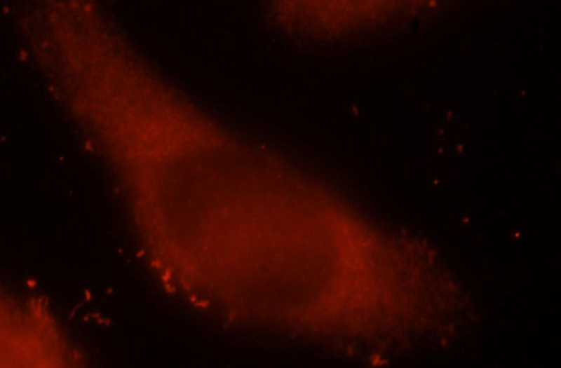 Immunofluorescent analysis of MCF-7 cells, using ICA1L antibody Catalog No:111585 at 1:25 dilution and Rhodamine-labeled goat anti-rabbit IgG (red).