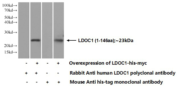 Transfected HEK-293 cells were subjected to SDS PAGE followed by western blot with Catalog No:112190(LDoc1 Antibody) at dilution of 1:350