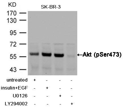 Western blot analysis of extracts from SK-BR-3 cells, treated with insulin and EGF, and pretreated with U0126 and LY294002 cells using Akt (Phospho-Ser473) Antibody .