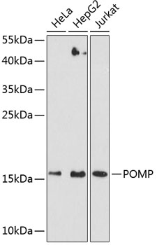 Western blot - POMP Polyclonal Antibody 