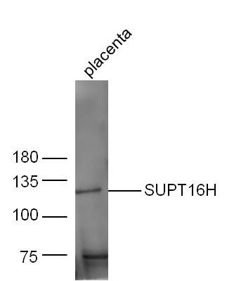 Fig1: Sample: Placenta (Mouse) Lysate at 40 ug; Primary: Anti-SUPT16H at 1/300 dilution; Secondary: IRDye800CW Goat Anti-Rabbit IgG at 1/20000 dilution; Predicted band size: 120 kD; Observed band size: 120 kD