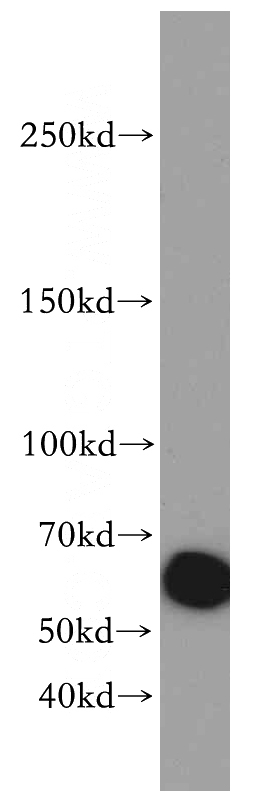 mouse heart tissue were subjected to SDS PAGE followed by western blot with Catalog No:111856(ITGA6-Specific antibody) at dilution of 1:300