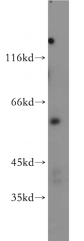 MCF7 cells were subjected to SDS PAGE followed by western blot with Catalog No:107950(AKT3 antibody) at dilution of 1:500