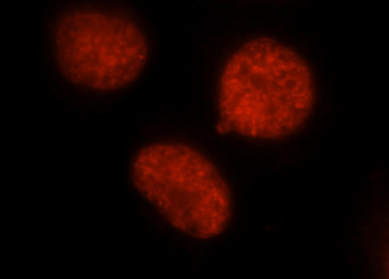 Immunofluorescent analysis of Hela cells, using DEK antibody Catalog No:109886 at 1:25 dilution and Rhodamine-labeled goat anti-rabbit IgG (red).