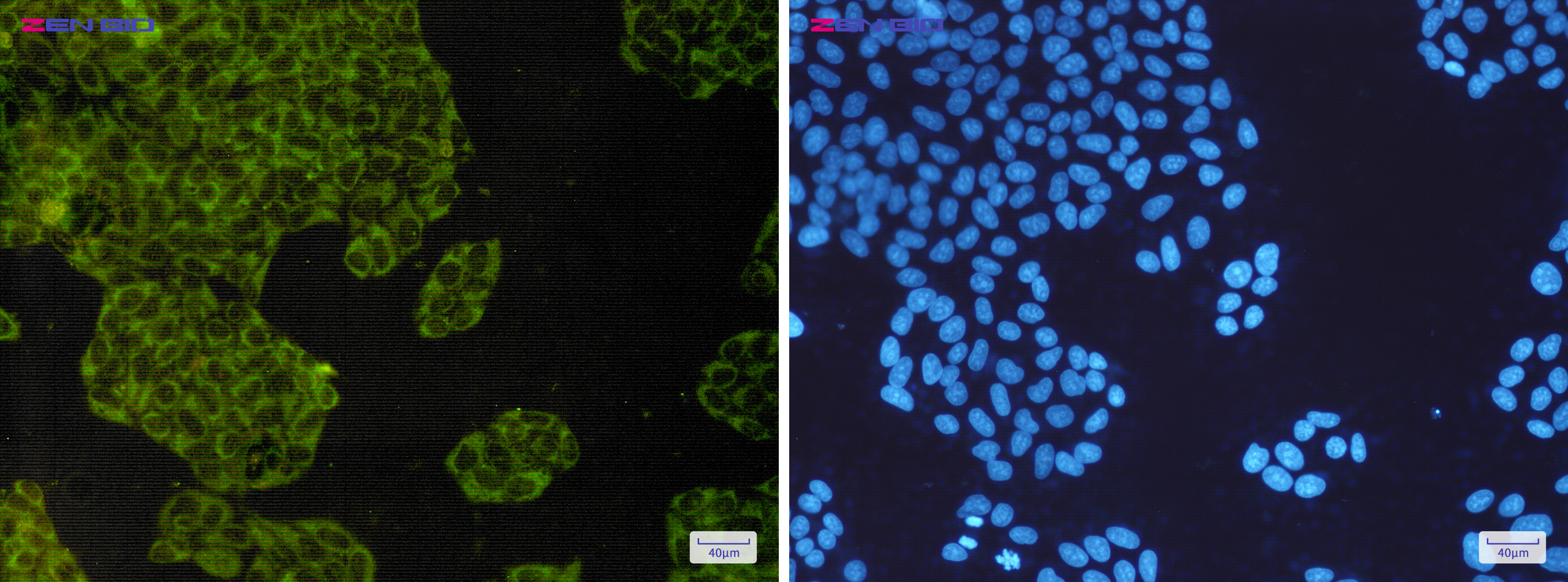 Immunocytochemistry of IMP3(green) in Hela cells using IMP3 Rabbit mAb at dilution 1/200, and DAPI(blue)