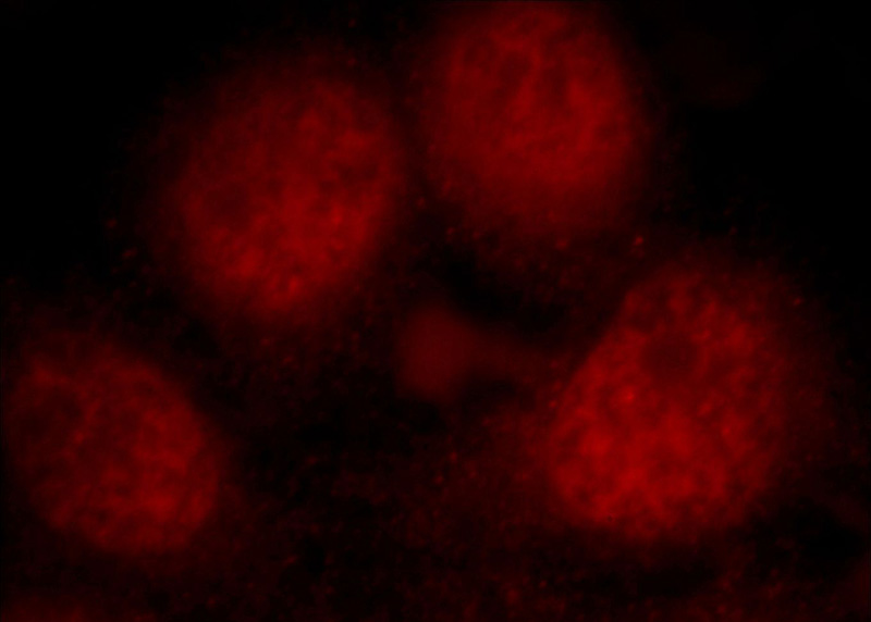Immunofluorescent analysis of Hela cells, using PKIG antibody Catalog No:113855 at 1:25 dilution and Rhodamine-labeled goat anti-rabbit IgG (red).