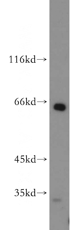 mouse thymus tissue were subjected to SDS PAGE followed by western blot with Catalog No:115217(SESN2 antibody) at dilution of 1:500