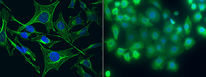 S100A5 Antibody, Mouse MAb, Immunofluorescence