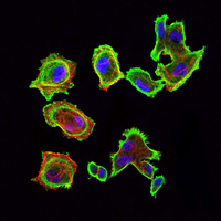 Immunofluorescence analysis of GC7901 cells using CDK5 mouse mAb (green). Blue