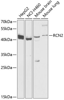 Western blot - RCN2 Polyclonal Antibody 