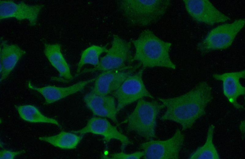 Immunofluorescent analysis of (10% Formaldehyde) fixed HeLa cells using Catalog No:107251(EIF3D Antibody) at dilution of 1:50 and Alexa Fluor 488-congugated AffiniPure Goat Anti-Mouse IgG(H+L)