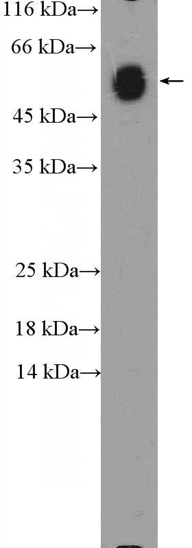 human plasma (0.3 ug) tissue were subjected to SDS PAGE followed by western blot with Catalog No:111720(Human IgA Antibody) at dilution of 1:1000. (1 Sec exposure)