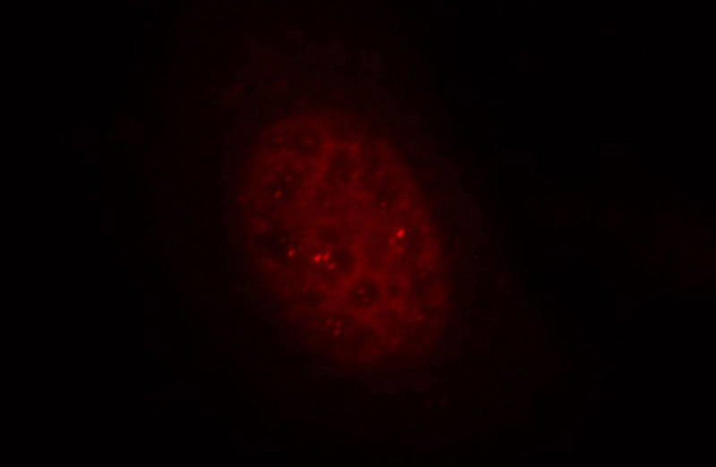 Immunofluorescent analysis of Hela cells, using ZKSCAN3 antibody Catalog No:117065 at 1:25 dilution and Rhodamine-labeled goat anti-rabbit IgG (red).