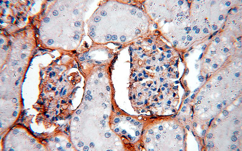Immunohistochemical of paraffin-embedded human kidney using Catalog No:111633(IGSF11 antibody) at dilution of 1:50 (under 40x lens)