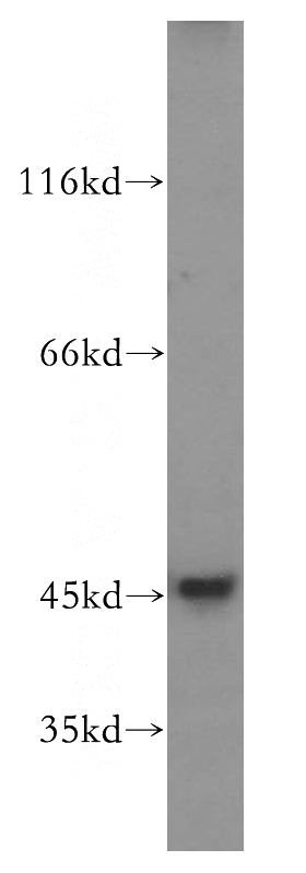 SH-SY5Y cells were subjected to SDS PAGE followed by western blot with Catalog No:111892(JNK antibody) at dilution of 1:300