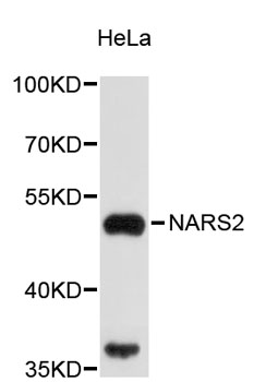 Western blot - NARS2 Polyclonal Antibody 