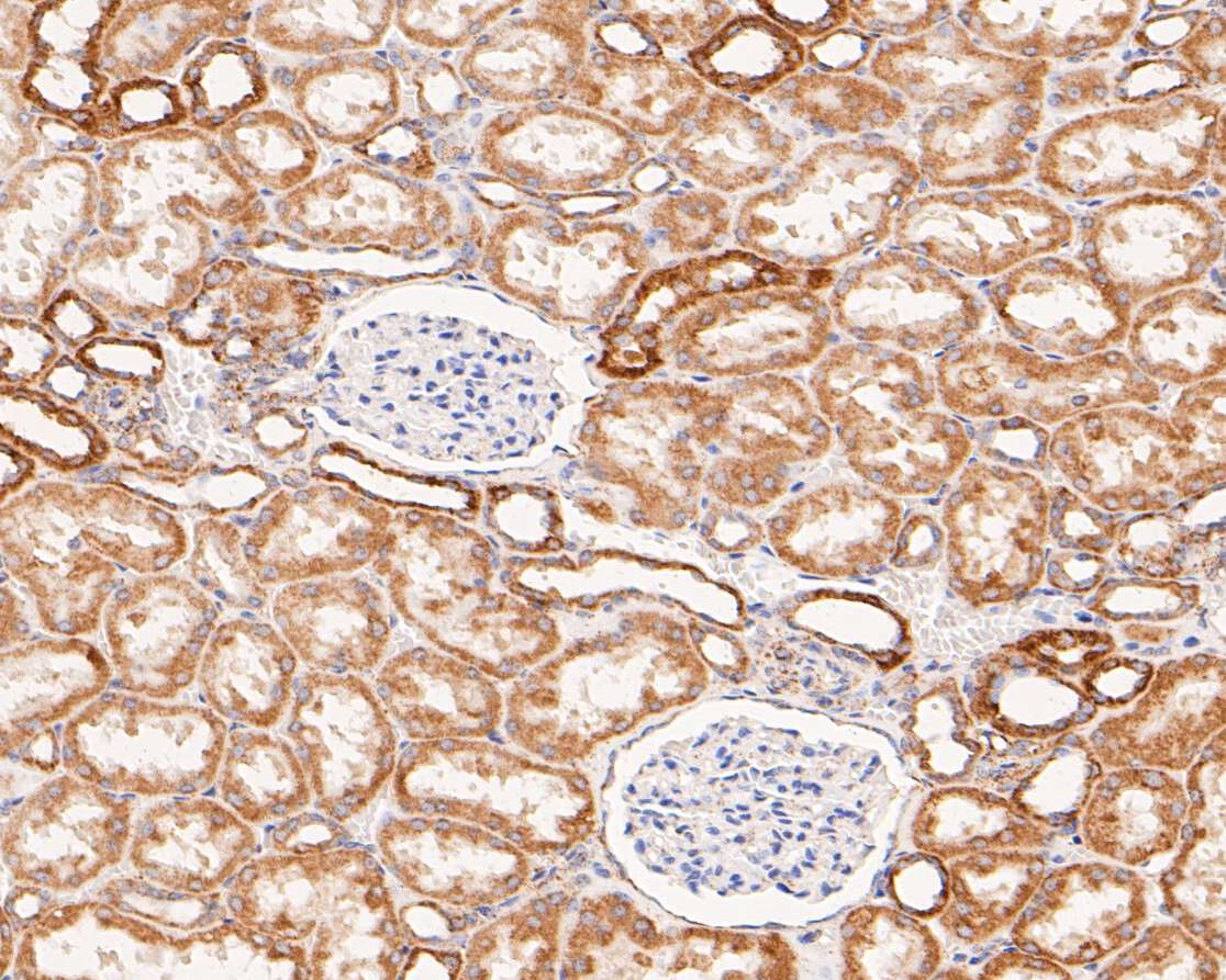 Fig6: Immunohistochemical analysis of paraffin-embedded human kidney tissue using anti-ZAC antibody. The section was pre-treated using heat mediated antigen retrieval with Tris-EDTA buffer (pH 8.0-8.4) for 20 minutes.The tissues were blocked in 5% BSA for 30 minutes at room temperature, washed with ddH2O and PBS, and then probed with the primary antibody ( 1/200) for 30 minutes at room temperature. The detection was performed using an HRP conjugated compact polymer system. DAB was used as the chromogen. Tissues were counterstained with hematoxylin and mounted with DPX.