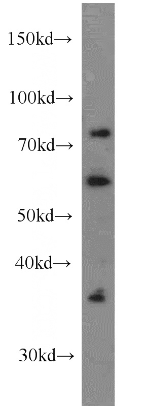 HeLa cells were subjected to SDS PAGE followed by western blot with Catalog No:112228(LIMK1 antibody) at dilution of 1:1000