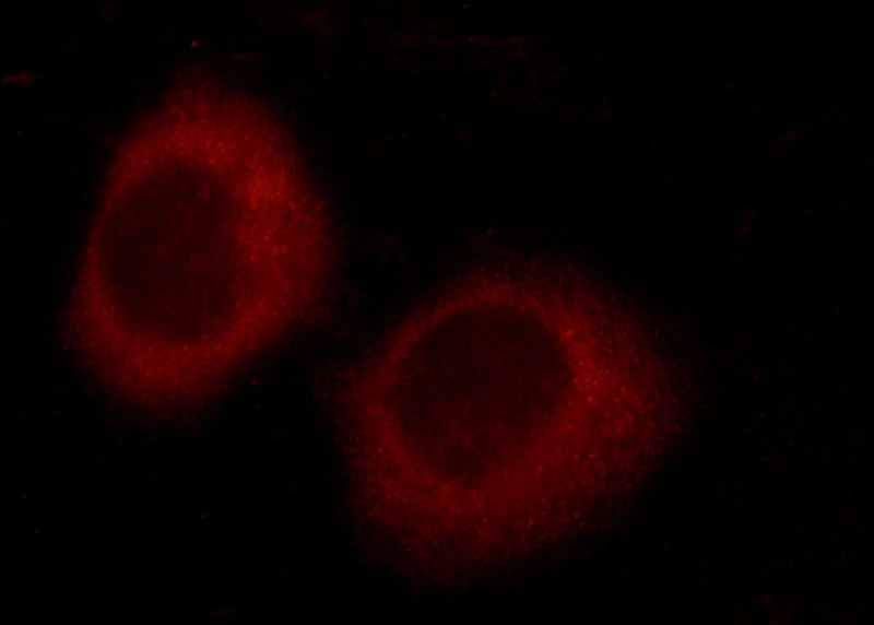 Immunofluorescent analysis of HepG2 cells using Catalog No:116383(TTC37 Antibody) at dilution of 1:25 and Rhodamine-Goat anti-Rabbit IgG