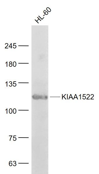 Fig1: Sample:; HL-60(Human) Cell Lysate at 30 ug; Primary: Anti- KIAA1522 at 1/1000 dilution; Secondary: IRDye800CW Goat Anti-Rabbit IgG at 1/20000 dilution; Predicted band size: 114 kD; Observed band size: 114 kD
